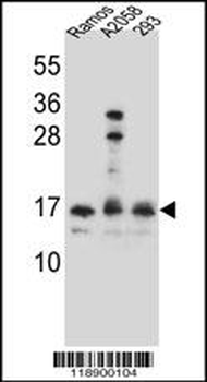 HOPX Antibody (C-term)