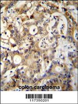 SP1 Antibody (C-term P692)