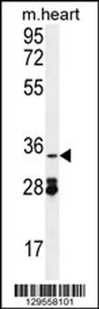 OXNAD1 Antibody (C-term)