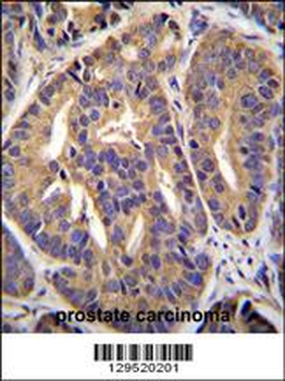 GTF2H2C Antibody (C-term)