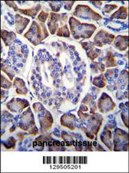 GDPD1 Antibody (N-term)