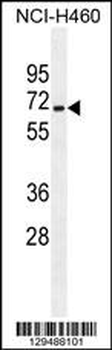 ZSCAN5B Antibody (C-term)