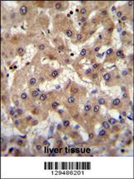 PRAMEF6 Antibody (C-term)