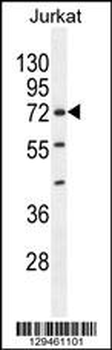 ZNF648 Antibody (N-term)