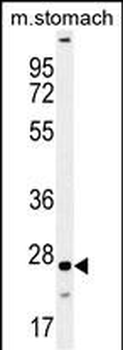 VSTM2B Antibody (N-term)