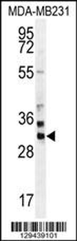 ZNF321 Antibody (N-term)
