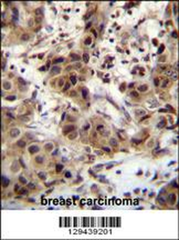 ZNF321 Antibody (N-term)