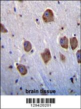 NT5DC4 Antibody (Center)