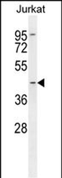 STPG3 Antibody (Center)