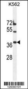 TMEM150B Antibody (N-term)