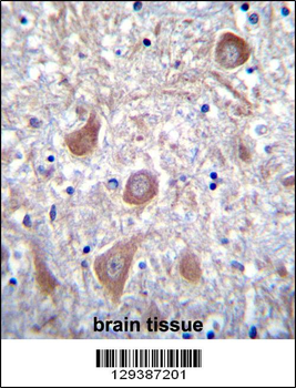 PTCHD1 Antibody (Center)