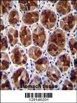 SERTAD4 Antibody (C-term)
