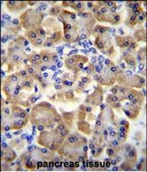 SLC35F3 Antibody (Center)