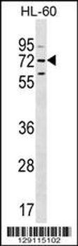 MBTD1 Antibody (C-term)