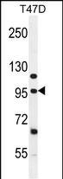 FAM160B1 Antibody (C-term)