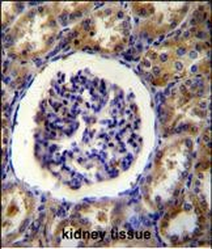FAM160B1 Antibody (C-term)