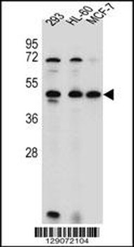 ANKRD40 Antibody (C-term)