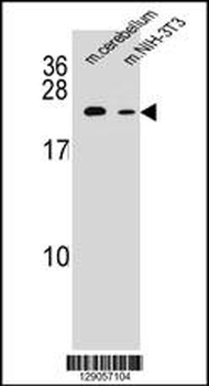 RAB12 Antibody (N-term)