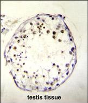 DNAAF3 Antibody (Center)