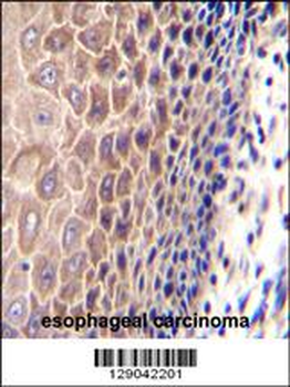 CCDC97 Antibody (C-term)