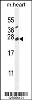 TNFAIP8L2 Antibody (N-term)