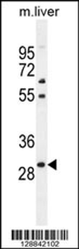 PHOX2B Antibody (Center)