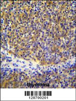PSMB11 Antibody (C-term)