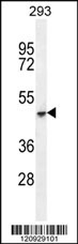 COCH Antibody (C-term)