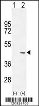 COCH Antibody (C-term)