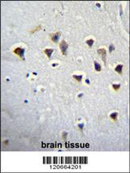 GRIN2A Antibody (Center)
