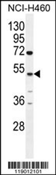 CPA6 Antibody (Center)