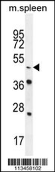 NR6A1 Antibody (N-term)