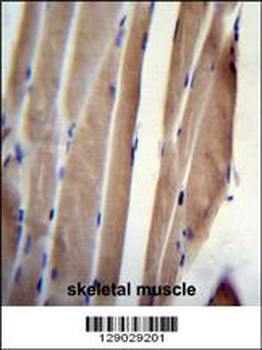 POLR2J Antibody (C-Term)