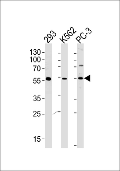 PIP5KL1 Antibody (N-term)