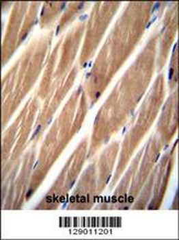 PIP5KL1 Antibody (N-term)
