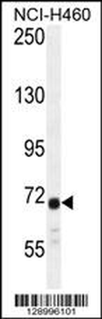 ATXN7L2 Antibody (C-term)