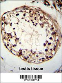 TSPYL6 Antibody (Center)