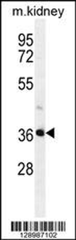 PIH1D2 Antibody (C-term)