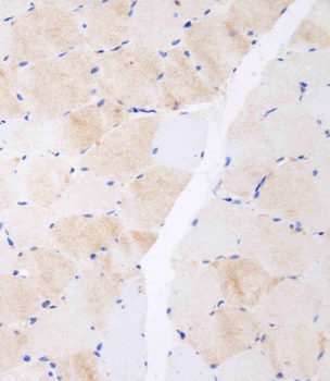 CLEC4F Antibody (C-term)
