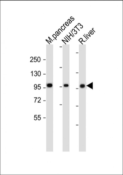 ALDH1L2 Antibody (C-term)