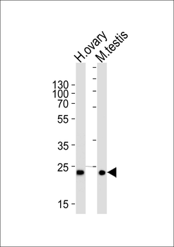 PLD6 Antibody (Center)