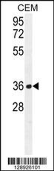 NUDT22 Antibody (C-term)