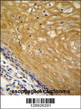 NUDT22 Antibody (C-term)