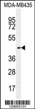 OR2L13 Antibody (C-term)
