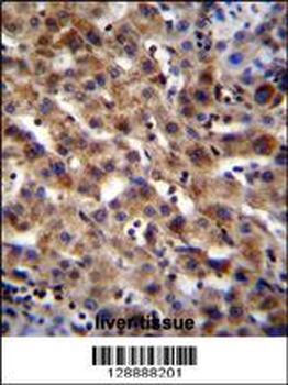 SPACA5B Antibody (N-term)