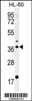 OR2W3 Antibody (C-term)