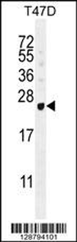 GAGE12B Antibody (N-term)
