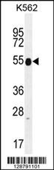 KRT25 Antibody (C-term)