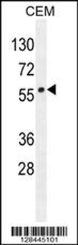 LIPC Antibody (N-term)