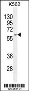 KRT73 Antibody (C-term)